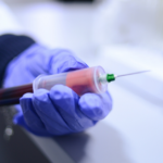 Blood plasma to treat coronavirus patients