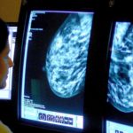 Breast cancer screening